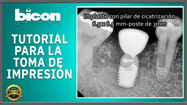 Tutorial para la toma de impresión