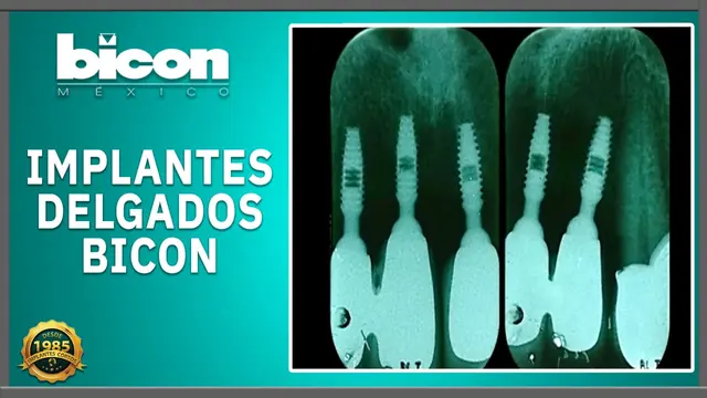 Implantes delgados Bicon
